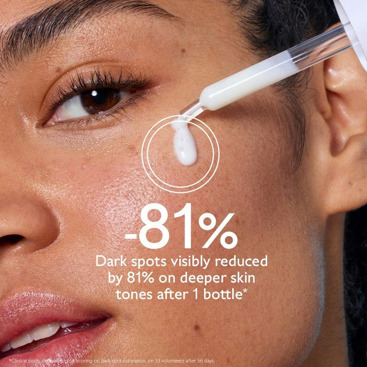 dark spot serum